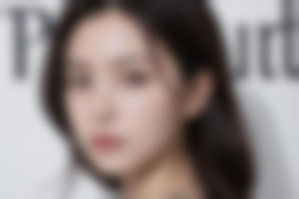 春燕医生眼部整形有哪些优势？