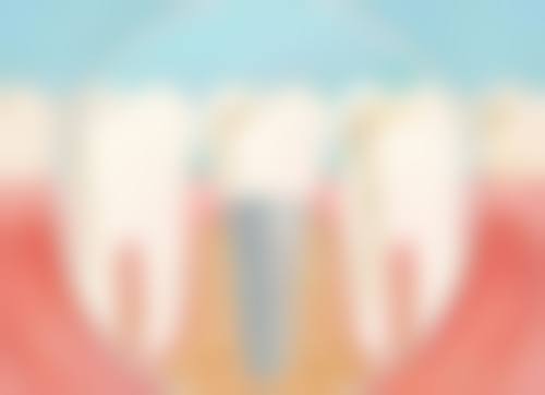 总结：奥齿泰US系列较便宜，适合预算型选择