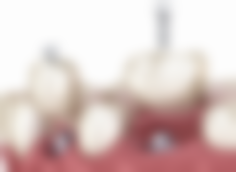 四、江苏徐州睢宁速美口腔设备介绍