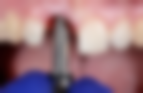 二、上饶信州区韩林口腔诊所医生团队，打造专精诊疗服务