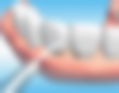 七、广州增城尹小玲口腔门诊部就医指南,便捷就诊不迷路