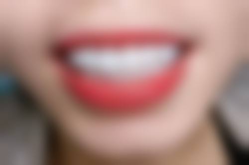 四、重庆泽生口腔诊所天山大道店设备介绍