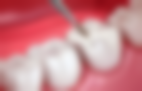 二、旬阳陈波口腔医生团队，打造专精诊疗服务