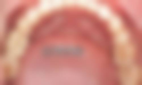 六、山东临沂李宝桂口腔诊所荣誉资质与患者口碑,见证品牌实力