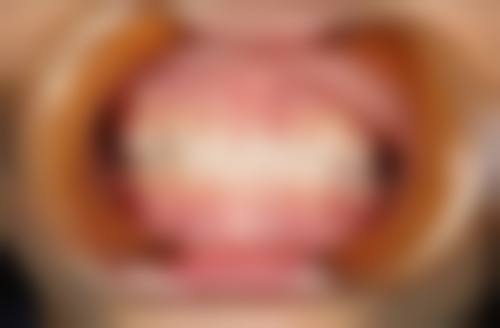 五、山东临沂李宝桂口腔诊所舒适就医环境,打造人性化诊疗体验