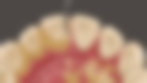 七、深圳微齿口腔诊所就医指南，便捷就诊不迷路