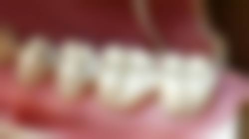 四、青海西宁小虎牙口腔诊所设备介绍