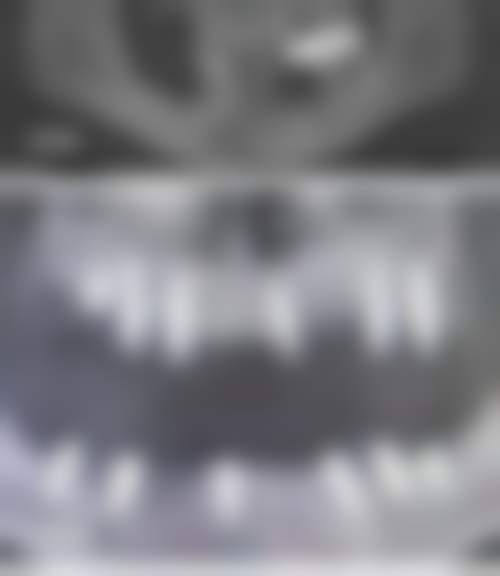 二、深圳康进口腔诊所医生团队，打造专精诊疗服务