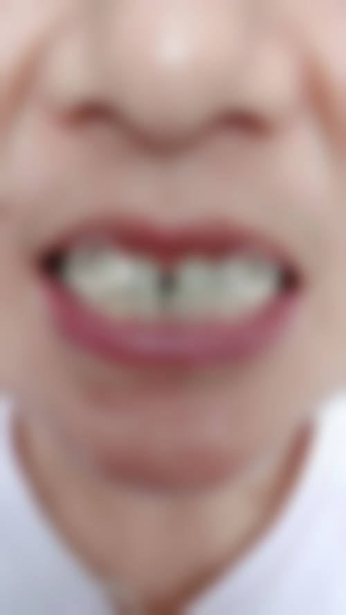 二、浙江金华东阳贝圣美口腔医生团队，打造专精诊疗服务