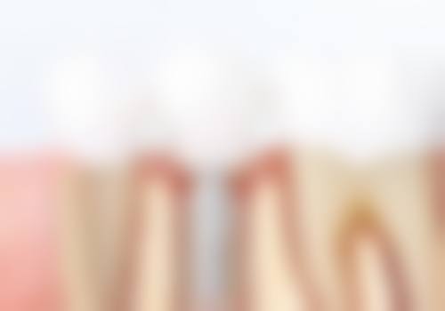 四、山东潍坊安丘锦安口腔设备介绍