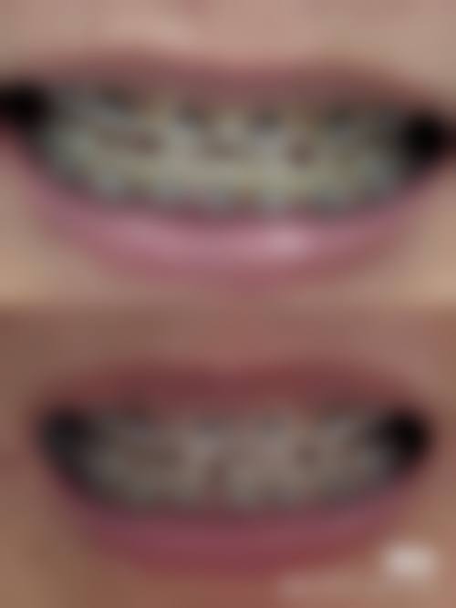 六、梅州市梅江区侯权斌口腔门诊部荣誉资质与患者口碑，见证品牌实力