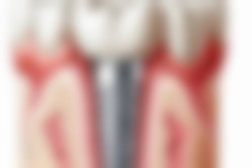 二、甘肃张掖品植口腔医院医生团队，打造专精诊疗服务