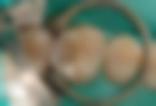 四、山东济南全民口腔设备介绍