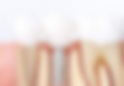 四、孝义维恩嘉诚口腔门诊部设备介绍