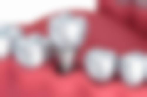 四、山东济南雅舒美口腔设备介绍