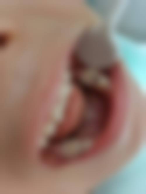 四、衡阳诚康口腔设备介绍