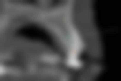 七、榆林高新口腔就医指南，便捷就诊不迷路