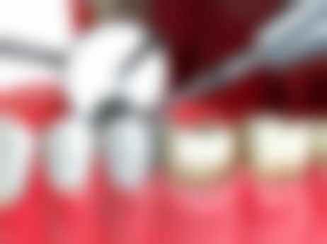 七、徐州宗斌口腔就医指南，便捷就诊不迷路