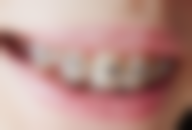 四、历城雅舒美口腔（中新国内外店）设备介绍