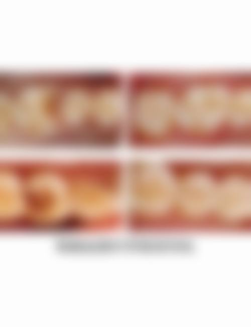 七、温州永嘉李成忠口腔就医指南，便捷就诊不迷路