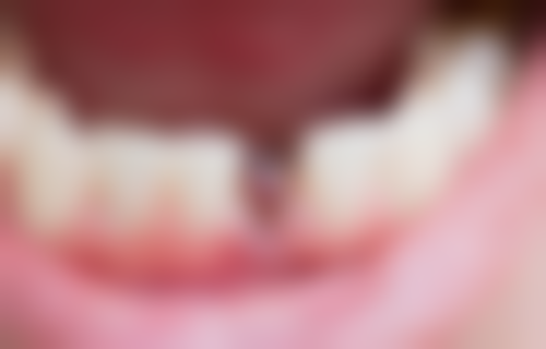 三、广东茂名琅城口腔核心科室与特色项目