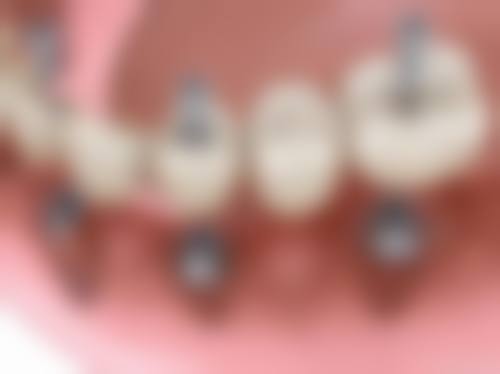 四、南京利康口腔设备介绍