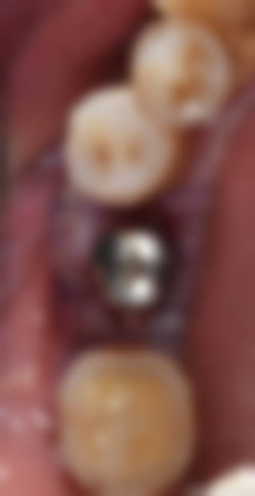 七、江西上饶口腔医院就医指南，便捷就诊不迷路