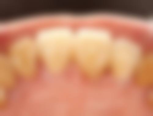 四、深圳圣文口腔设备介绍