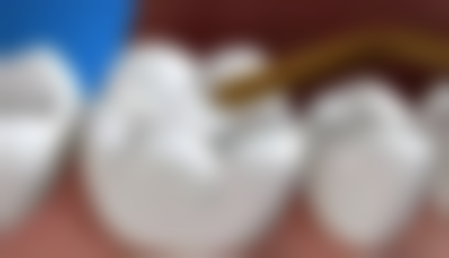 七、湖南娄底市雅美口腔就医指南，便捷就诊不迷路