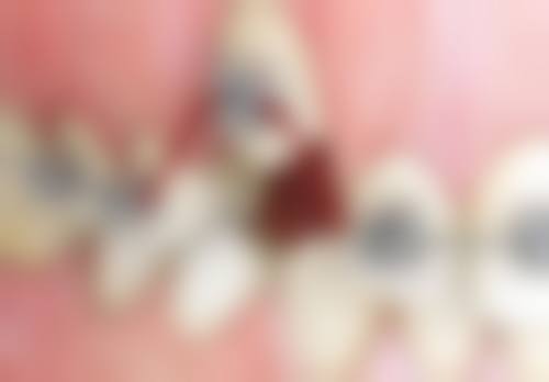 四、湖南长沙张氏口腔设备介绍