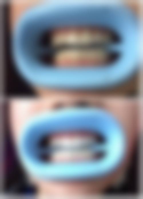 四、苏州常熟文悦口腔设备介绍