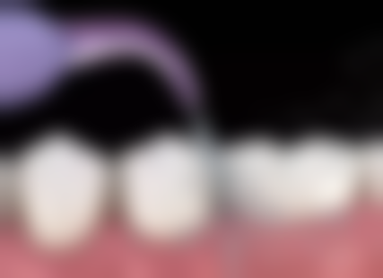 二、苏州常熟文悦口腔医生团队，打造专精诊疗服务