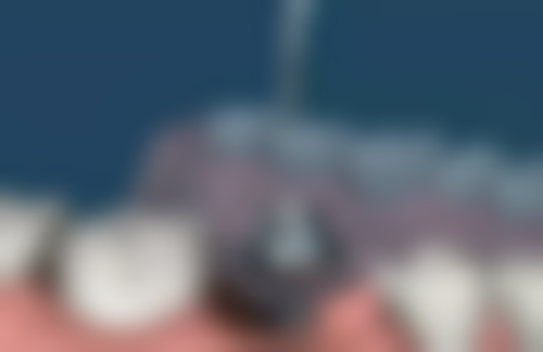 三、金华永康周宏亮口腔核心科室与特色项目