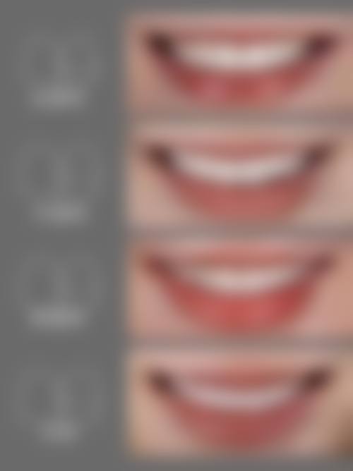 四、成都恒美植发设备介绍