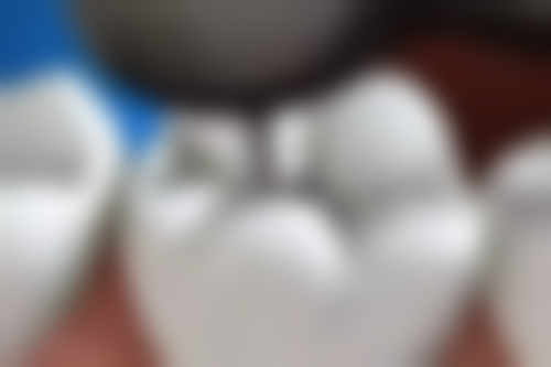 四、重庆海狸博士口腔设备介绍