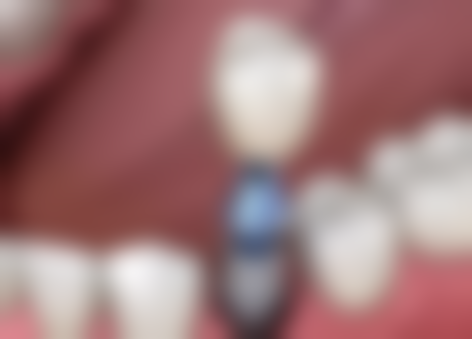 二、北京精德口腔(财富中 心店)医生团队，打造专精诊疗服务