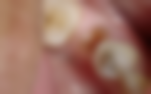 二、江苏苏州俞春霞口腔诊所医生团队，打造专精诊疗服务