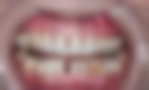 二、重庆垫江柳氏口腔医生团队,打造专精诊疗服务