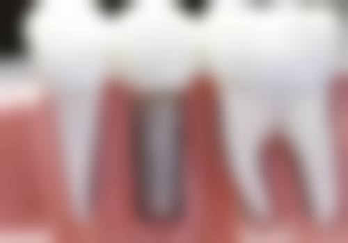 七、乌鲁木齐天牙口腔门诊部(铁路局店)就医指南，便捷就诊不迷路