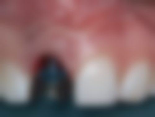 二、阜阳市人民医院口腔科医生团队,打造专精诊疗服务