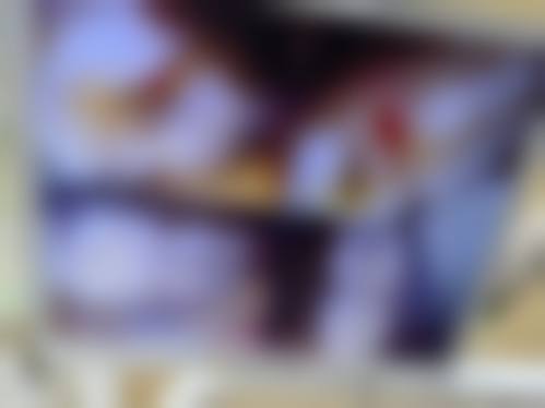 四、阜阳市人民医院口腔科设备介绍