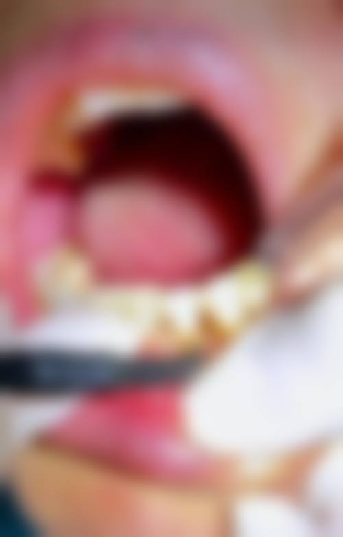 七、湖南张家界邓开兵口腔诊所就医指南，便捷就诊不迷路