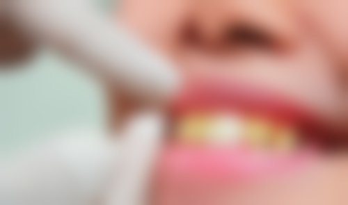 二、深圳正恩口腔门诊部梅林分院医生团队,打造专精诊疗服务