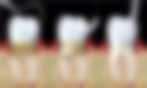 四、深圳正恩口腔门诊部梅林分院设备介绍