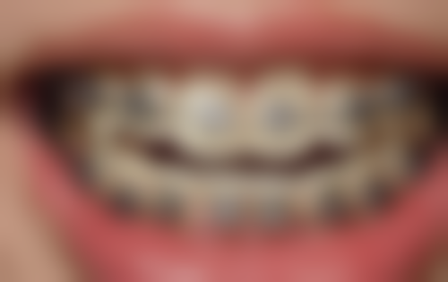 四、惠州微笑天使水口店设备介绍