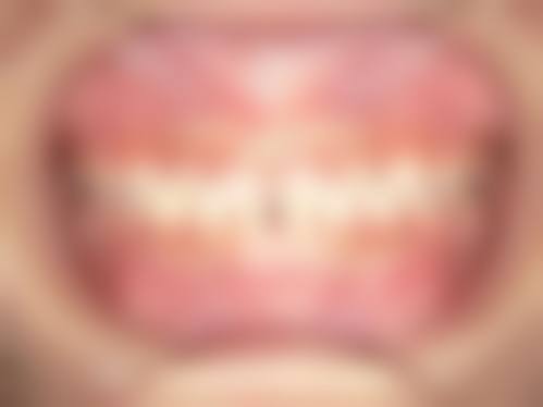 六、广东深圳雅仕口腔诊所荣誉资质与患者口碑,见证品牌实力