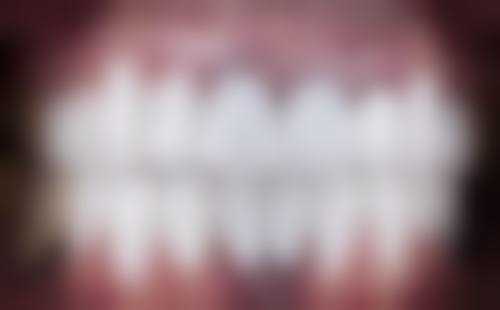 四、宁波馨齿口腔设备介绍