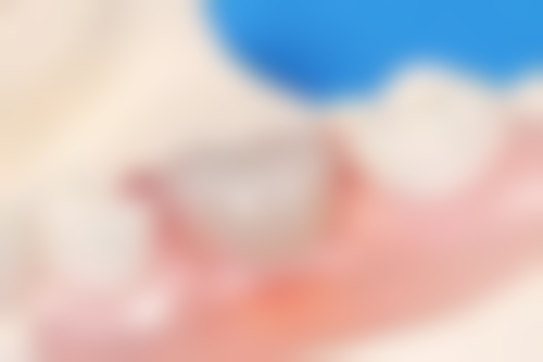 六、巴彦淖尔张渊口腔荣誉资质与患者口碑，见证品牌实力