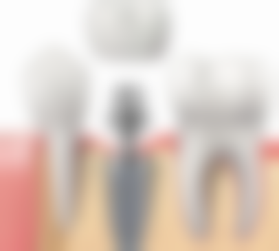 四、邛崃京川口腔诊所设备介绍