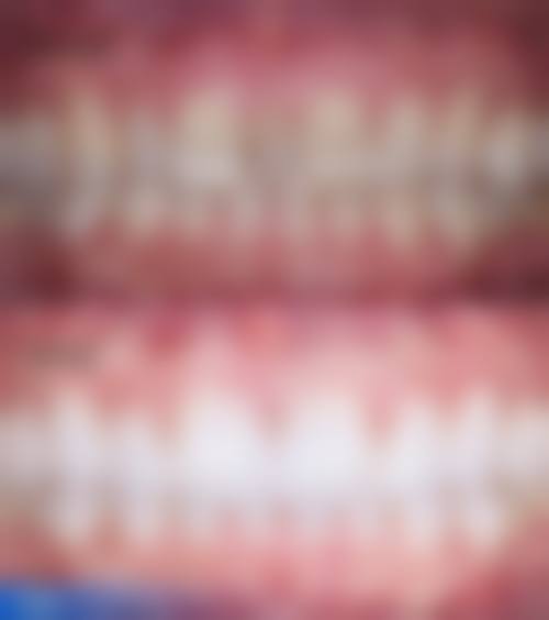 七、深圳泓岳口腔诊所就医指南，便捷就诊不迷路